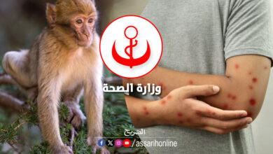 Variole du singe