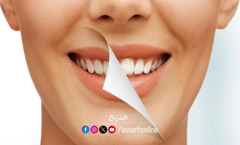 Dents blanches