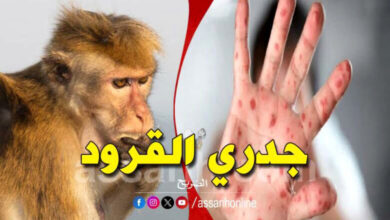 monkey pox