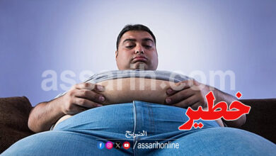obese man