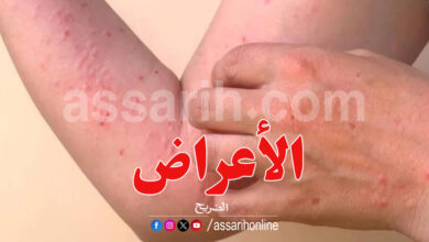 verus Chikungunya