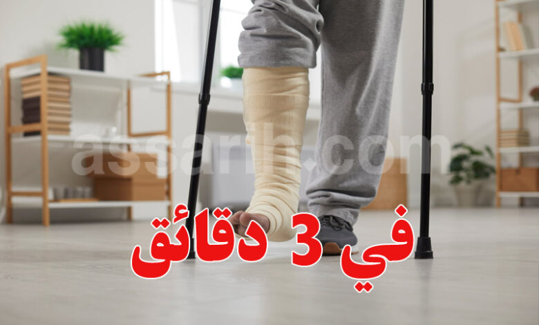 fracture jambe