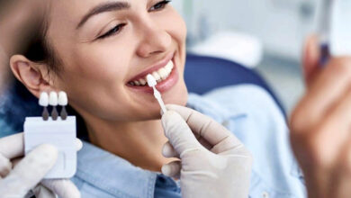 Blanchiment des dents