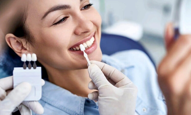 Blanchiment des dents