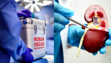 organ transplant 165112025 (1)