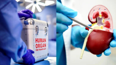 organ transplant