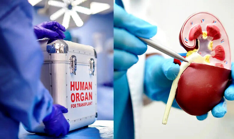 organ transplant