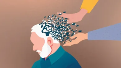 alzheimer