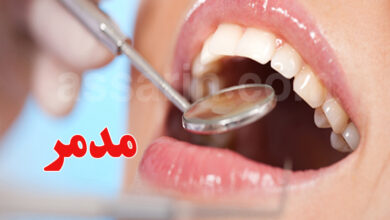 Le sucre affecte les dents