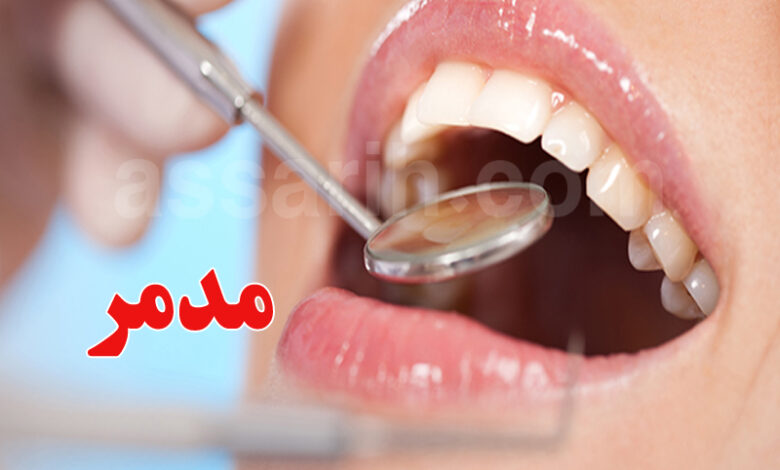 Le sucre affecte les dents