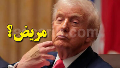 TRUMP BRUISES