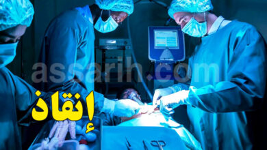 organ transplant