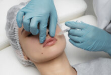 Chirurgie esthetique
