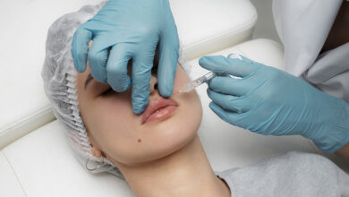 Chirurgie esthetique
