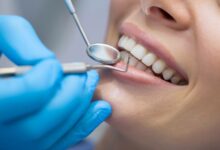 dentiste